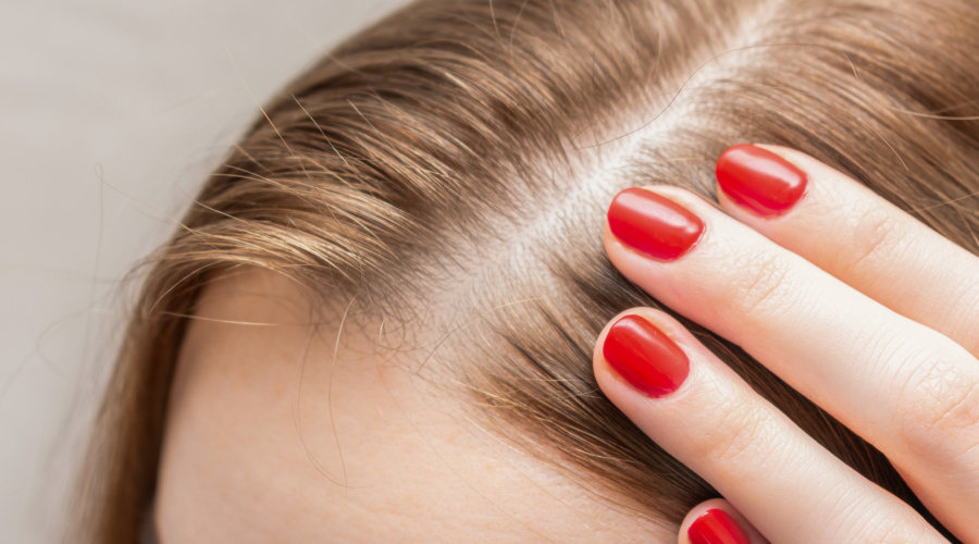 Haarausfall-Behandlung mit PRP