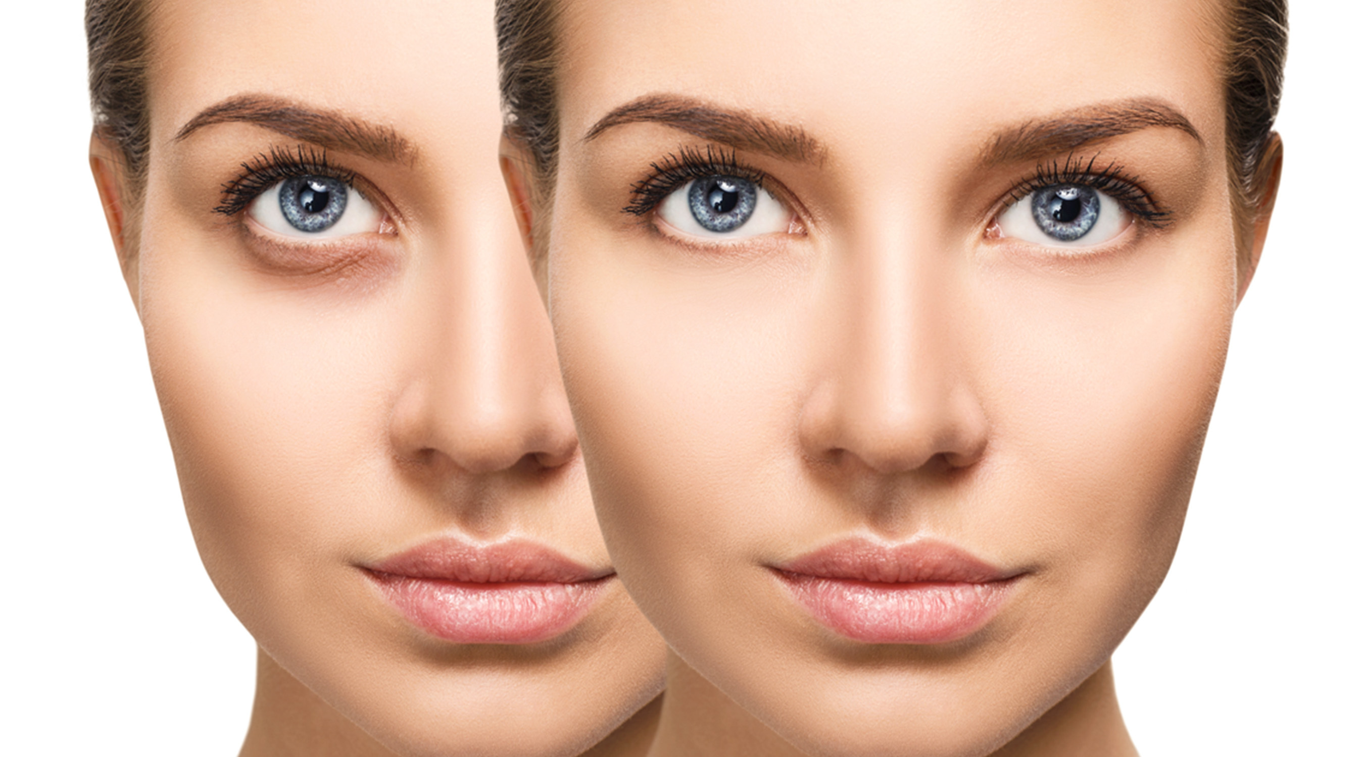 <p>LaseMD laser treatment in Zurich</p>